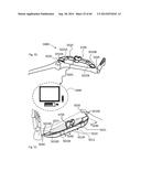 METHOD TO MEASURE MEDIAL-LATERAL OFFSET RELATIVE TO A MECHANICAL AXIS diagram and image