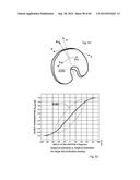 METHOD TO MEASURE MEDIAL-LATERAL OFFSET RELATIVE TO A MECHANICAL AXIS diagram and image