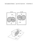 METHOD TO MEASURE MEDIAL-LATERAL OFFSET RELATIVE TO A MECHANICAL AXIS diagram and image