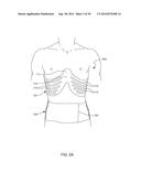 Distraction and Mobility Back Support diagram and image