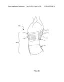 Distraction and Mobility Back Support diagram and image