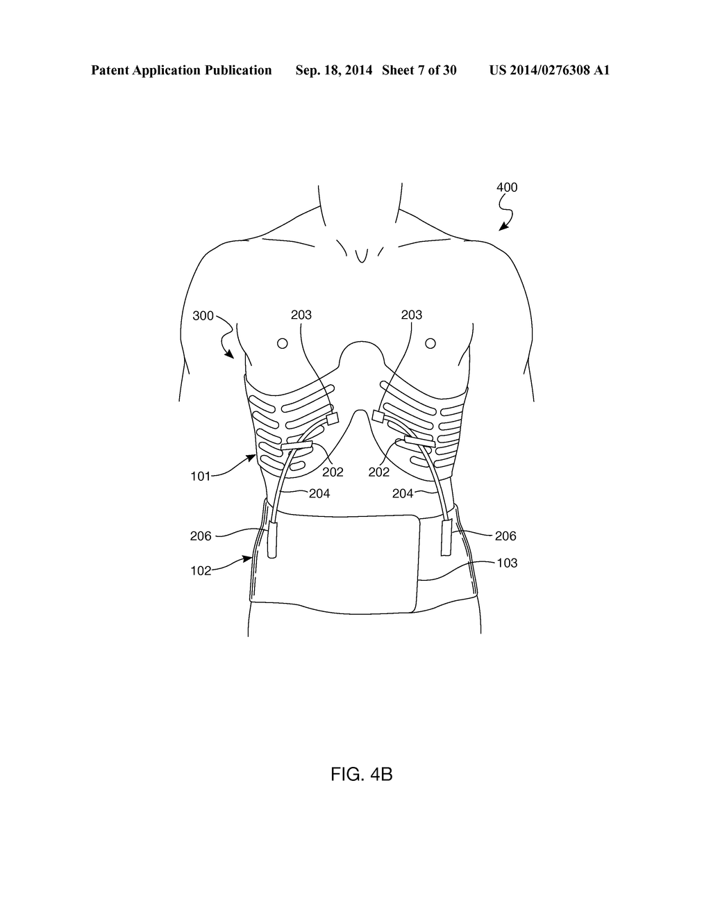 Distraction and Mobility Back Support - diagram, schematic, and image 08