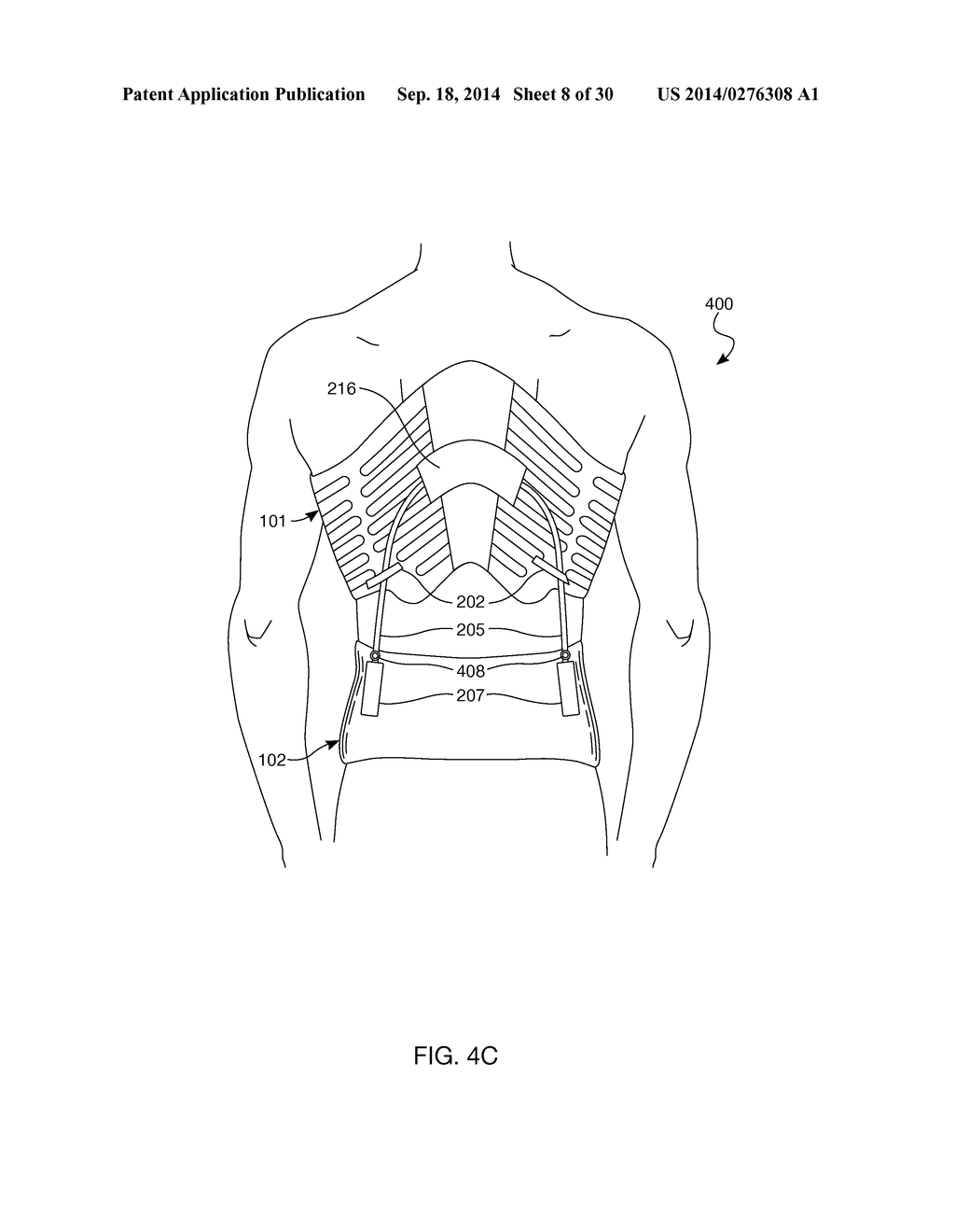 Distraction and Mobility Back Support - diagram, schematic, and image 09