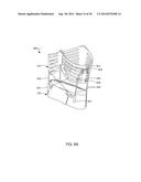 Distraction and Mobility Back Support diagram and image