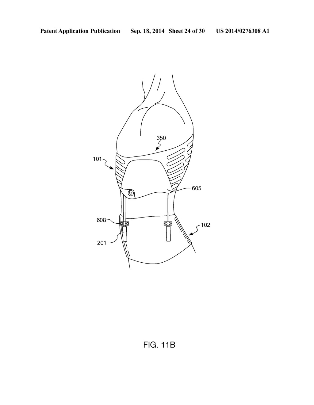 Distraction and Mobility Back Support - diagram, schematic, and image 25