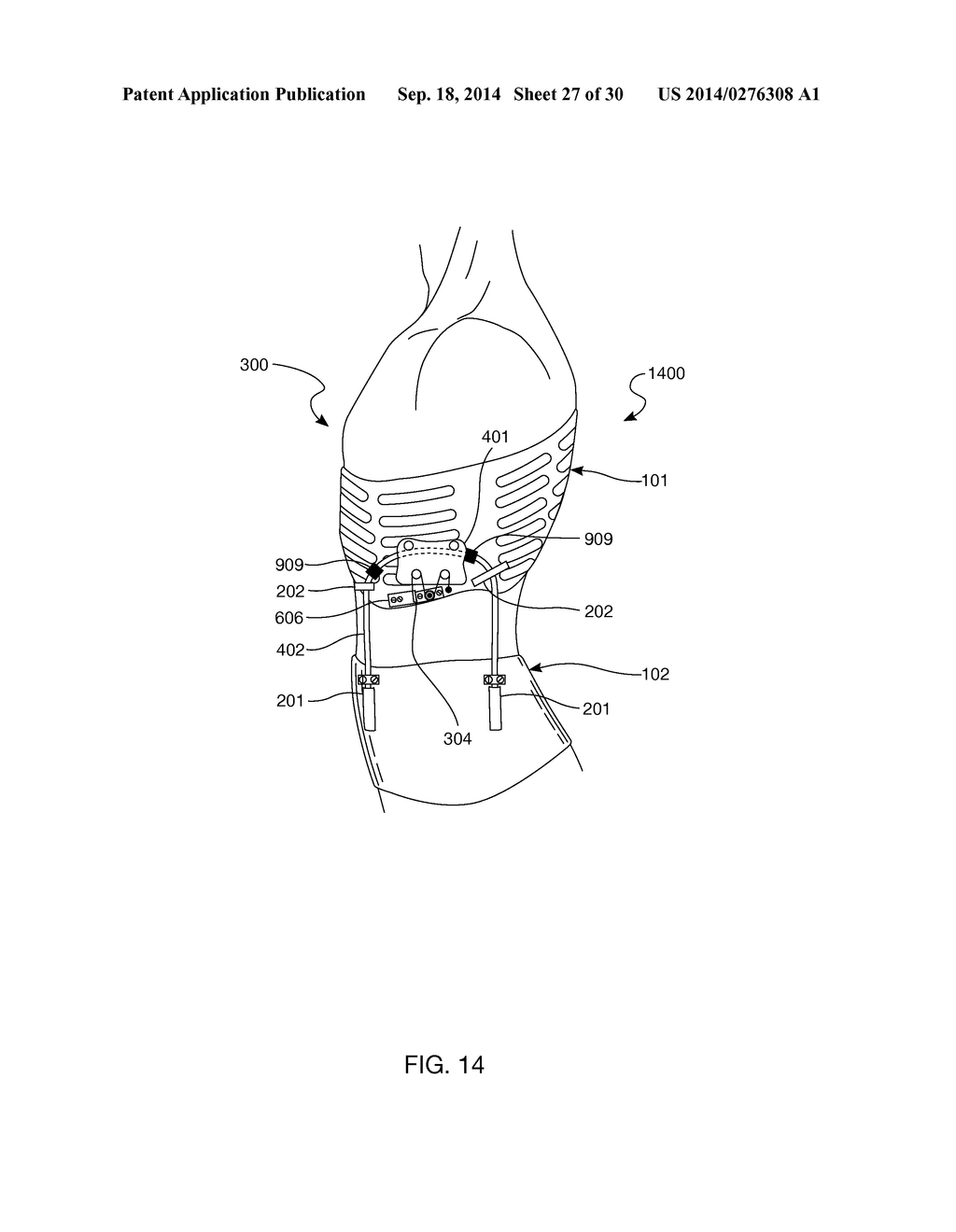 Distraction and Mobility Back Support - diagram, schematic, and image 28