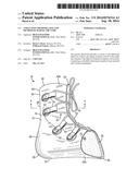 Ankle Foot Orthosis (AFO) and Method of Making the Same diagram and image