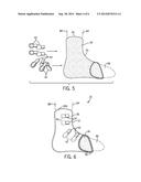 Ankle Foot Orthosis (AFO) and Method of Making the Same diagram and image