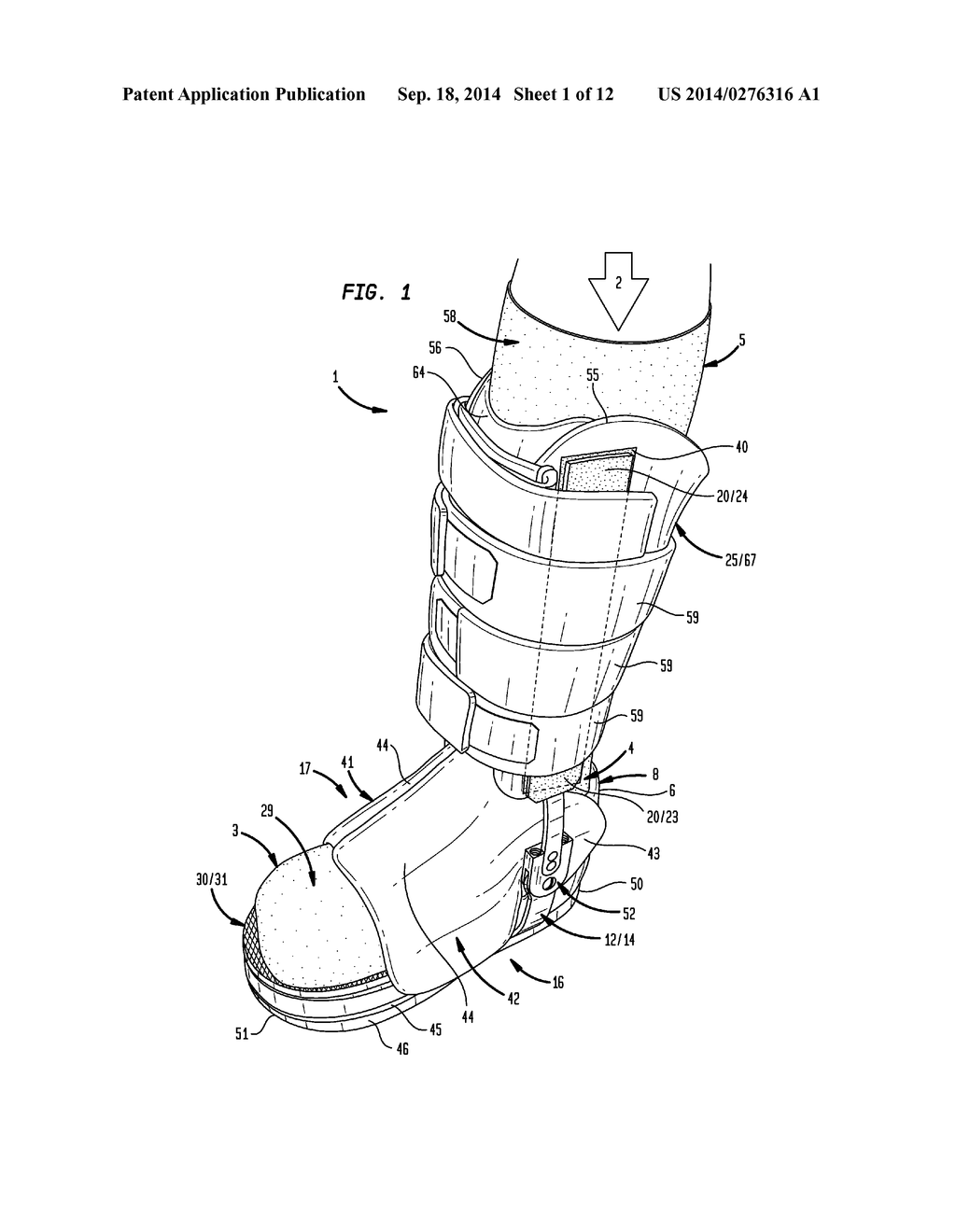 Ankle-Foot Orthosis - diagram, schematic, and image 02