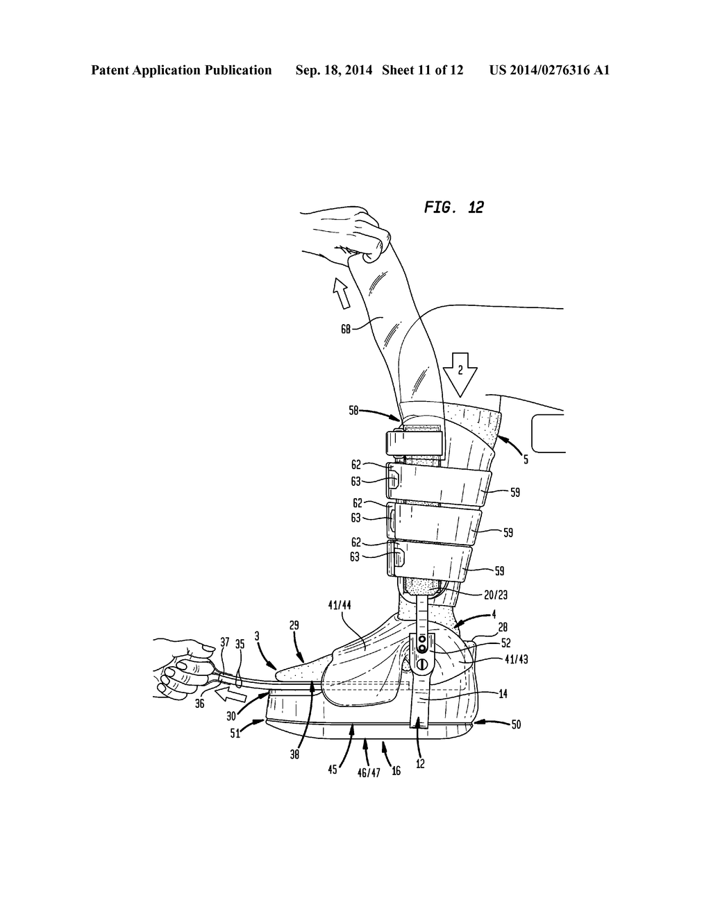 Ankle-Foot Orthosis - diagram, schematic, and image 12