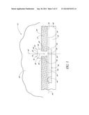 GLAUCOMA STENT AND METHODS THEREOF FOR GLAUCOMA TREATMENT diagram and image