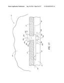 GLAUCOMA STENT AND METHODS THEREOF FOR GLAUCOMA TREATMENT diagram and image