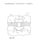 GLAUCOMA STENT AND METHODS THEREOF FOR GLAUCOMA TREATMENT diagram and image