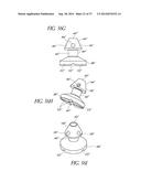 GLAUCOMA STENT AND METHODS THEREOF FOR GLAUCOMA TREATMENT diagram and image