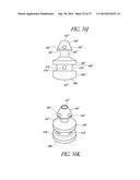 GLAUCOMA STENT AND METHODS THEREOF FOR GLAUCOMA TREATMENT diagram and image