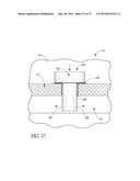 GLAUCOMA STENT AND METHODS THEREOF FOR GLAUCOMA TREATMENT diagram and image