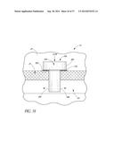 GLAUCOMA STENT AND METHODS THEREOF FOR GLAUCOMA TREATMENT diagram and image