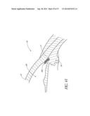 GLAUCOMA STENT AND METHODS THEREOF FOR GLAUCOMA TREATMENT diagram and image