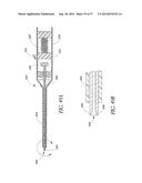 GLAUCOMA STENT AND METHODS THEREOF FOR GLAUCOMA TREATMENT diagram and image