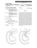 SYSTEM AND METHOD FOR GASTRIC RESTRICTION AND MALABSORPTION diagram and image