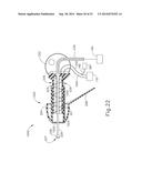 SYSTEM AND METHOD FOR PROVIDING IONTOPHORESIS AT TYMPANIC MEMBRANE diagram and image