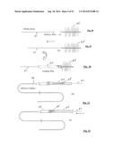 EMBOLIZATION SYSTEMS diagram and image