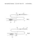 EMBOLIZATION SYSTEMS diagram and image