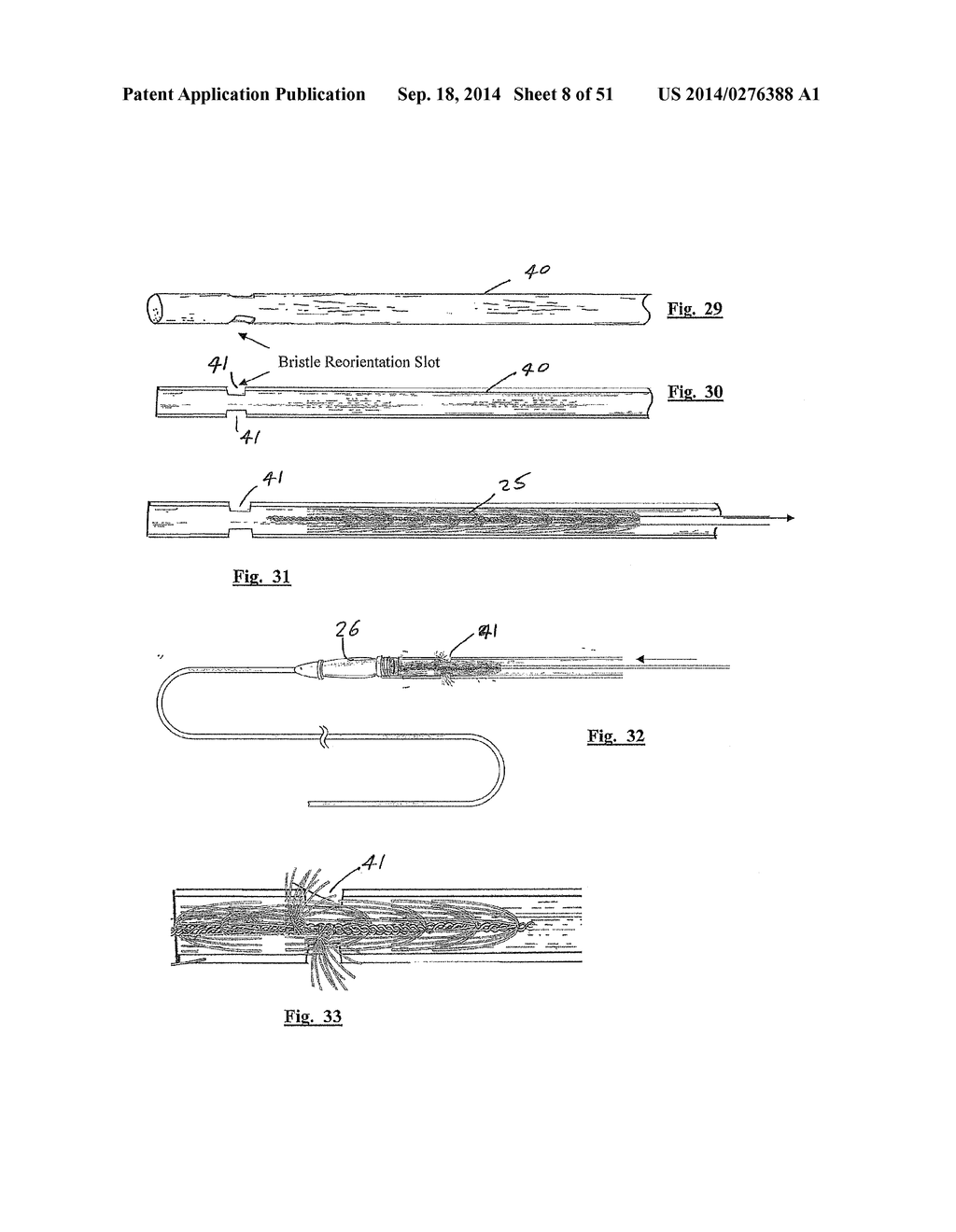 EMBOLIZATION SYSTEMS - diagram, schematic, and image 09