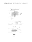 EMBOLIZATION SYSTEMS diagram and image