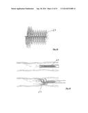 EMBOLIZATION SYSTEMS diagram and image