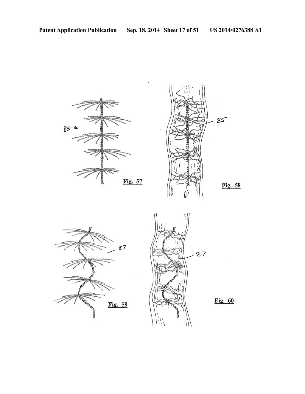 EMBOLIZATION SYSTEMS - diagram, schematic, and image 18