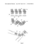 EMBOLIZATION SYSTEMS diagram and image