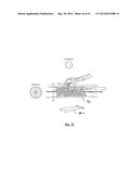 EMBOLIZATION SYSTEMS diagram and image