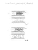 EMBOLIZATION SYSTEMS diagram and image