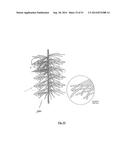 EMBOLIZATION SYSTEMS diagram and image