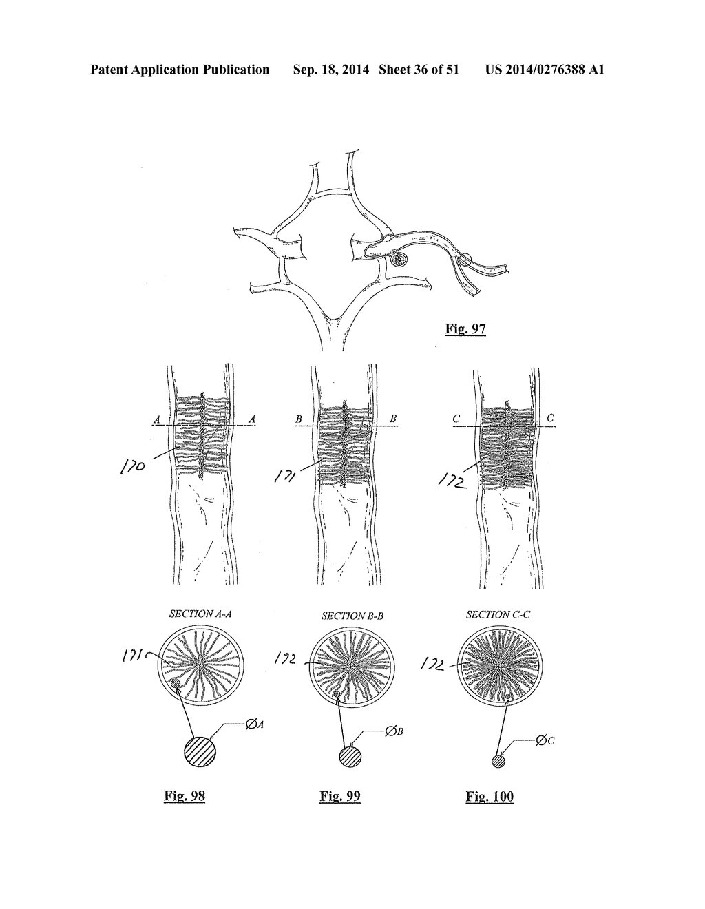 EMBOLIZATION SYSTEMS - diagram, schematic, and image 37