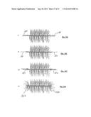 EMBOLIZATION SYSTEMS diagram and image