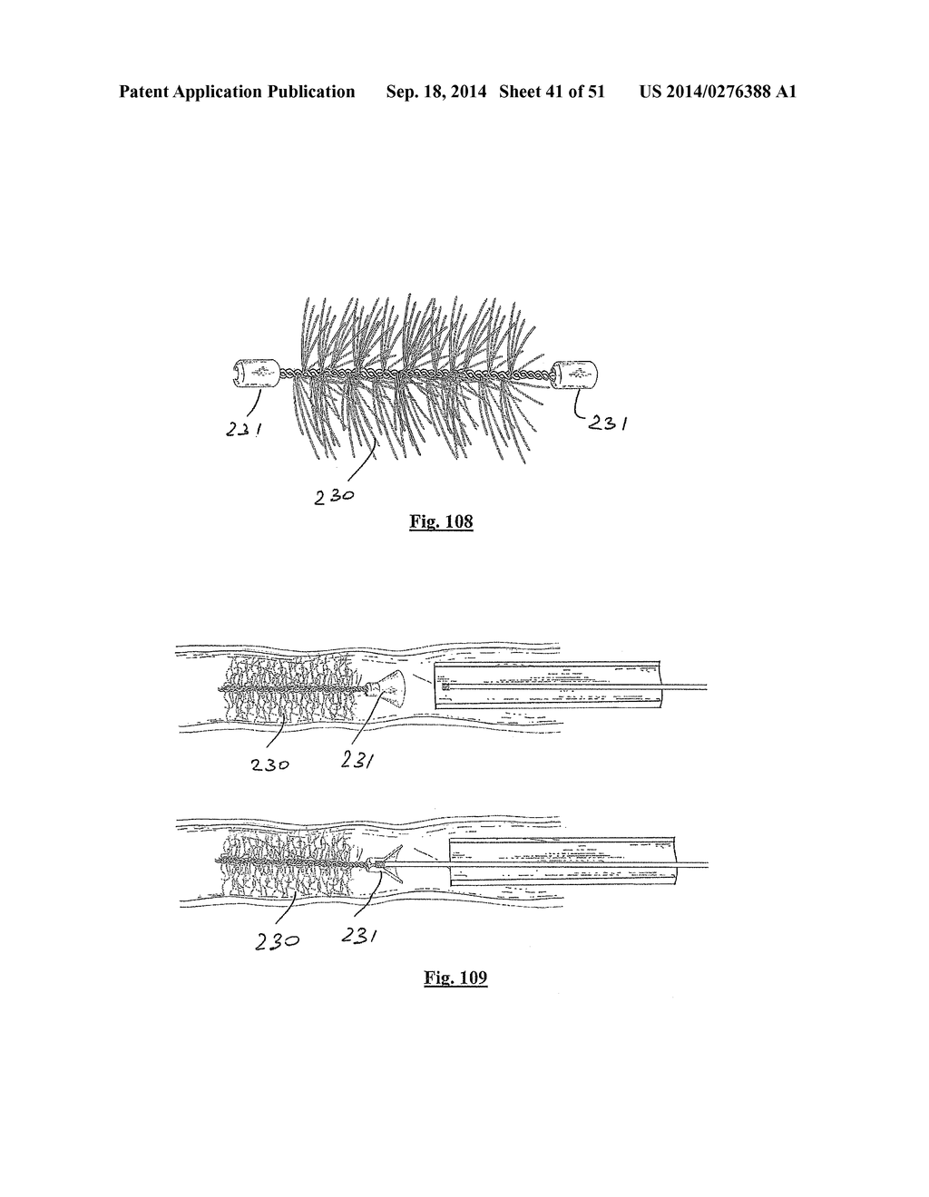 EMBOLIZATION SYSTEMS - diagram, schematic, and image 42