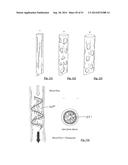 EMBOLIZATION SYSTEMS diagram and image