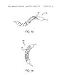 CONFORMABLE BALLOON DEVICES AND METHODS diagram and image