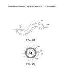 CONFORMABLE BALLOON DEVICES AND METHODS diagram and image