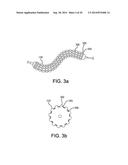 CONFORMABLE BALLOON DEVICES AND METHODS diagram and image