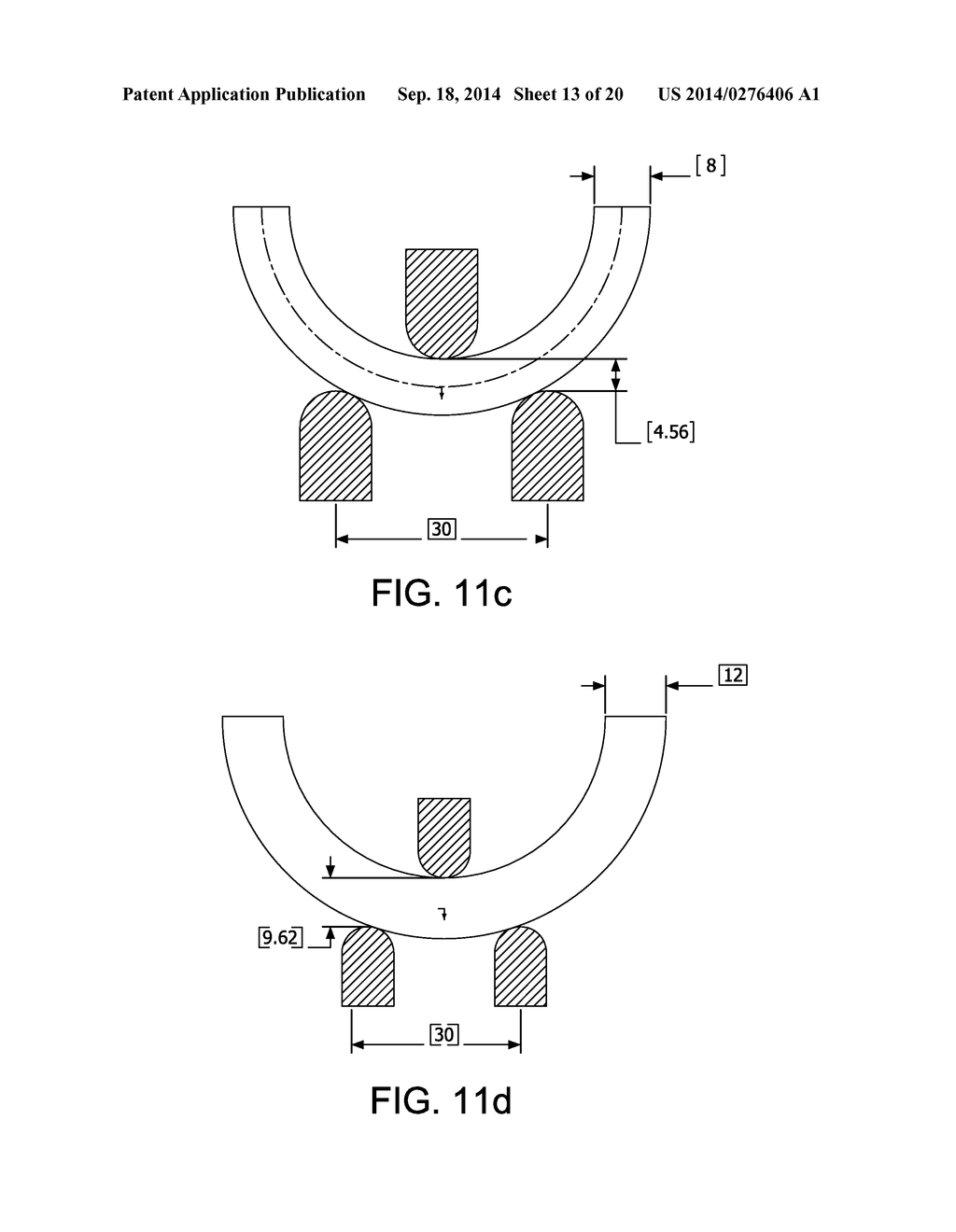 CONFORMABLE BALLOON DEVICES AND METHODS - diagram, schematic, and image 14