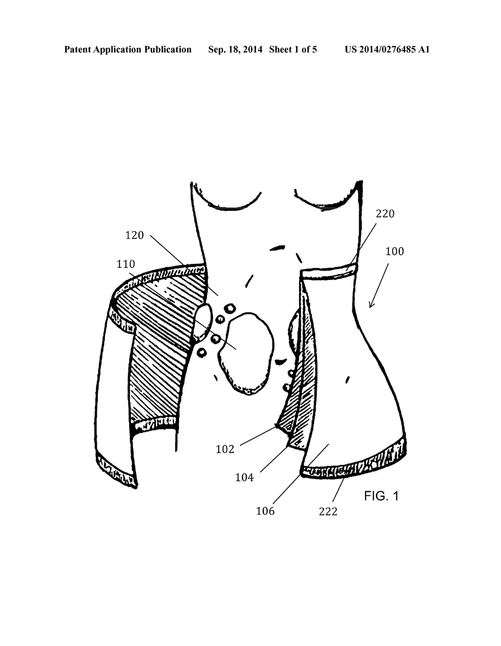 STRETCH MARK THERAPY AND MOISTURIZING GARMENT - diagram, schematic, and image 02