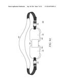 MEDICAL DEVICE, METHOD OF MAKING AND USING THE SAME diagram and image