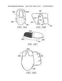 MEDICAL DEVICE, METHOD OF MAKING AND USING THE SAME diagram and image