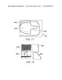 MEDICAL DEVICE, METHOD OF MAKING AND USING THE SAME diagram and image