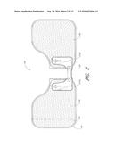 MEDICAL ARTICLE SECUREMENT DEVICE diagram and image