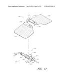 MEDICAL ARTICLE SECUREMENT DEVICE diagram and image