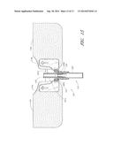 MEDICAL ARTICLE SECUREMENT DEVICE diagram and image